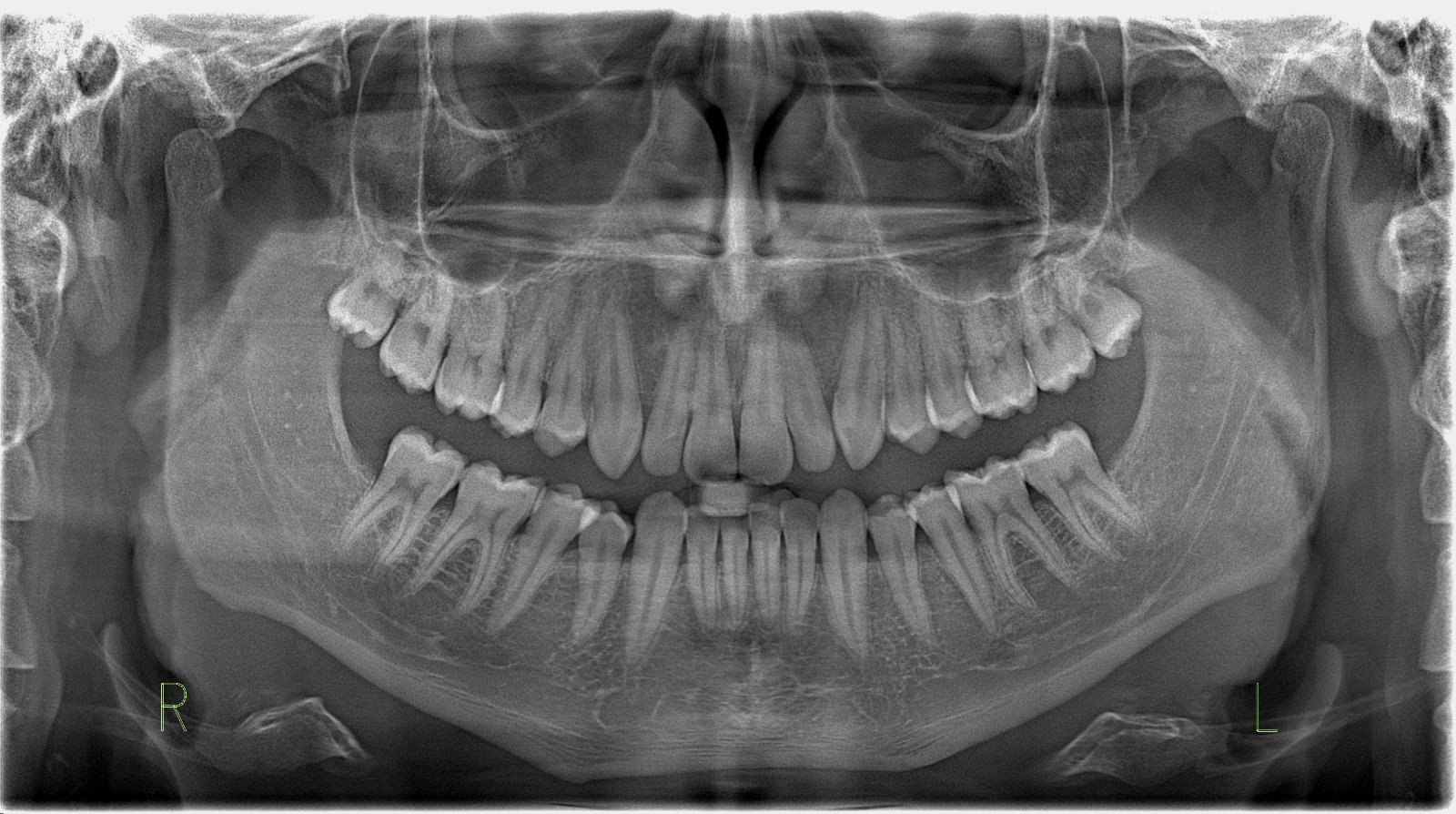 Avaliação de imagem odontológica em tela